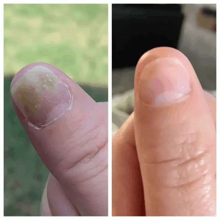 Fungabeam customer review Bailey D.